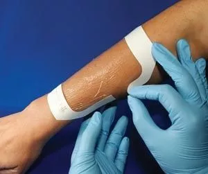 AMD Ritmed Dressing Window Allevyn AG PU Flm 6x7cm Non-Adhesive 400/Ca