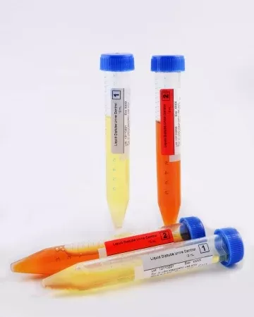 BTNX Urinalysis Control Rapid Response2 X 12 Ml Level 2 - M-897876-1820 | Box of 1