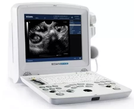 Edan USA Ultrasound System DUS 60 256 Frame Cine Loop Memory, 504 MB Built-In Image Storage, Two USB ports, 7 Types Pseudo Color, 100 to 240 V, 50 to 60 Hz Power Supply - M-1031580-1708 | Each