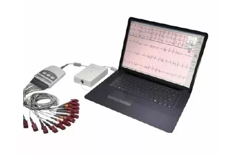 GE Healthcare Resting ECG System GE CardioSoft AC Power / Battery Operated Digital Display - M-1132510-1853 | Each
