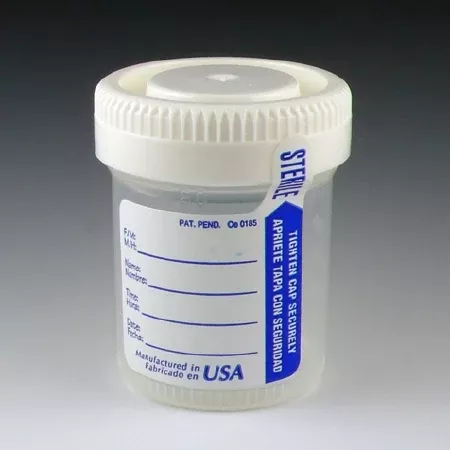 Globe Scientific Specimen Container with Temperature Strip Tite-Rite Polypropylene 60 mL (2 oz.) Screw Cap Patient Information Sterile - M-999618-4456 | Case of 500