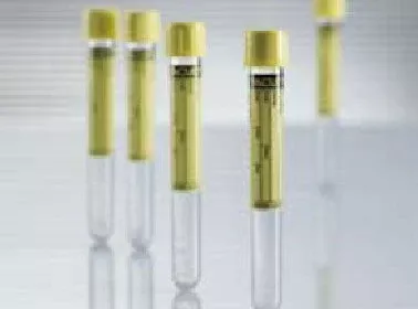 Greiner Bio-One VACUETTE Urinalysis Tube Conical Bottom Plain 16 X 100 mm 9.5 mL Yellow Pull Cap Polyethylene Terephthalate (PET) Tube - M-470580-4085 | CA/1200