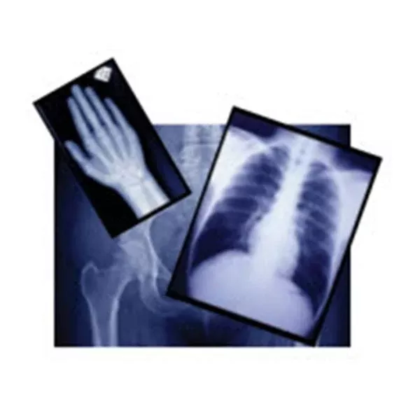 Henry ScheinFilm X-Ray 24x30cm 100/Bx, 5 BX/CA (9004286)