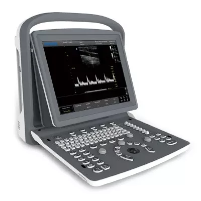 Imaging Associates Ultrasound System Chison 256 Levels Scale, 240 mm Max Depth Scanning, 3 USB ports, 1 Probe Connectors, 8 GB Memory Card, PW Mode - M-1045459-4193 | Each