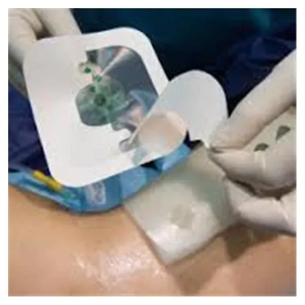 IVT Medical LTD Dressing Wound Multiple Ingredients 15x20cm Kit Sterile Ea (SWDK2030)