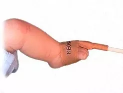 Mediaid Inc SpO2 Sensor Medplast Finger - M-999501-2450 | Case of 24