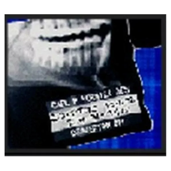 Medical Id SystemsFilter Density X-Rite Marker L&R Indicat Ea