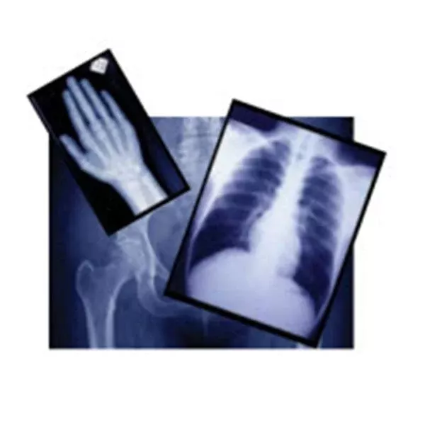 Medlink Imaging Film X-Ray 15x30cm 100/Bx, 5 BX/CA (EZP4F)