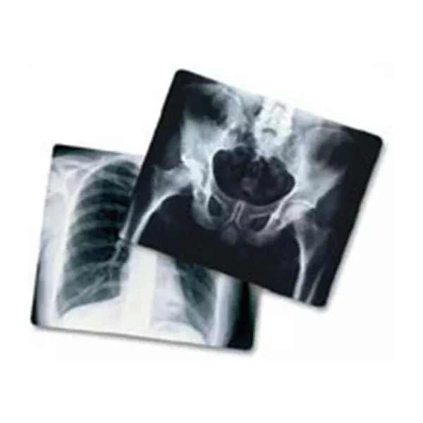 Medlink Imaging Film X-Ray AGFA Radiomat 14x35" 25/Bx