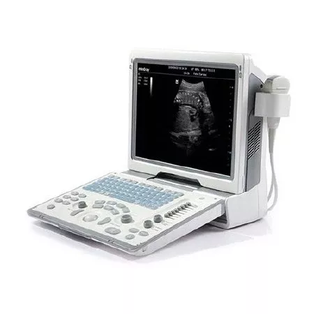 Mindray USA Ultrasound System DP-50 - M-1062717-2090 | Each