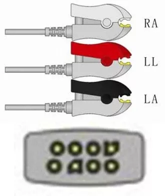 Sage Services Group ECG Leadset Sage Services 3 Lead, Grabber, 0.9m - M-796678-3140 | Each