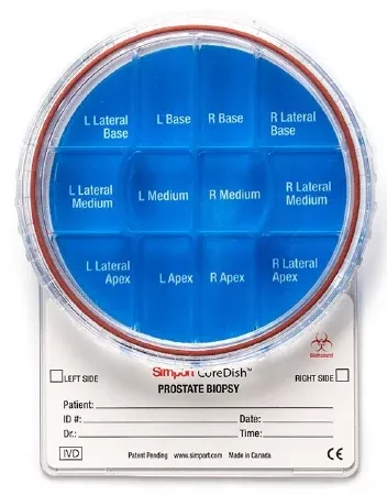 Simport Scientific Prostate Biopsy Container CoreDish 15 X 95 mm Polystyrene Screw Cap Warning Label / Patient Information NonSterile - M-1035142-1579 | Case of 10
