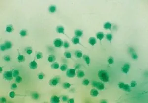 Ward's Science Teaching Microscope Slide Aspergillus Conidiophores 1 X 3 Inch - M-959215-2284 | Each