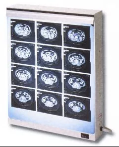 Wolf X-Ray Illuminator Econoline 3 Bank Wall Mount 17 X 42 Inch White - M-690252-4304 | Each