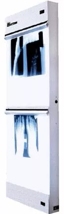 Wolf X-Ray X-Ray Illuminator Trimline Basic 1 Bank 1 Tier 2 Lamp 15 W Wall Mount 3-1/4 X 14 X 22 Inch White One, 14 X 17 Inch Film - M-491717-2922 | Each