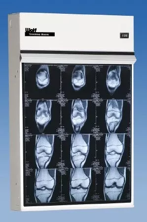 Wolf X-Ray X-Ray Illuminator Trimline Basic 8 Bank 2 Tier 2 Lamp Wall Mount 56 W X 44 H X 3-1/4 D Inch Eight, 17 L X 14 W Inch Film - M-652991-4978 | Each