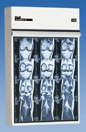 Wolf X-Ray X-Ray Illuminator Trimline III 3 Bank 1 Tier 3 Lamp 15 W Mobile Stand 42 W X 22 H X 3-1/4 D Inch Three, 17 L X 14 W Inch Film - M-683145-3140 | Each
