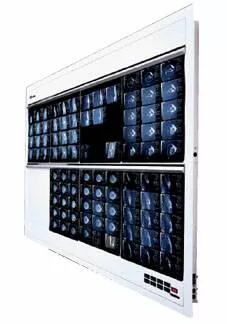 Wolf X-Ray X-Ray Illuminator Trimline Plus 1 Bank 1 Tier 4 Lamp 15 W Wall Mount 3-1/4 X 14 X 22 Inch White One, 14 X 17 Inch Film - M-503442-4608 | Each