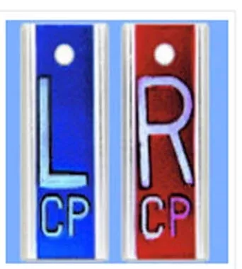 Wolf X-Ray X-Ray Marker Set 1 Inch Blue / Red Left / Right 1 Set - M-664949-2639 | ST/1